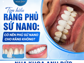 Tìm hiểu răng phủ sứ nano: Có nên phủ sứ nano cho răng không?