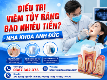 Điều trị viêm tủy răng bao nhiêu tiền?