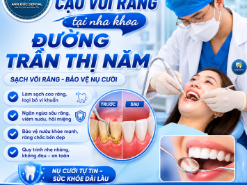 Cạo vôi răng tại nha khoa đường Trần Thị Năm