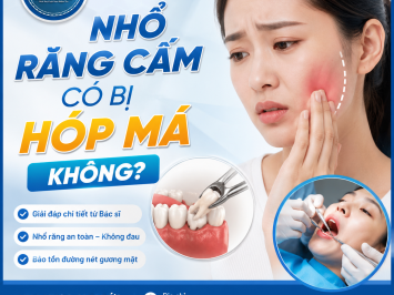 Nhổ răng cắm có bị hóp má không?