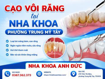 Cạo vôi răng tại nha khoa phường Trung Mỹ Tây