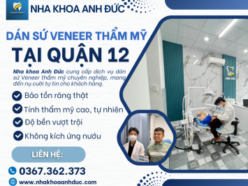 Dán sứ Veneer thẩm mỹ tại quận 12